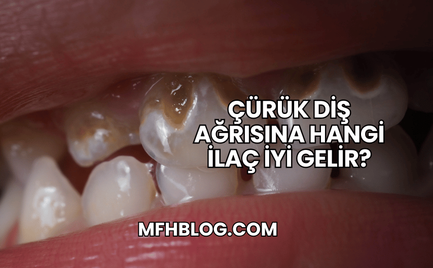 Çürük Diş Ağrısına Hangi İlaç İyi Gelir?