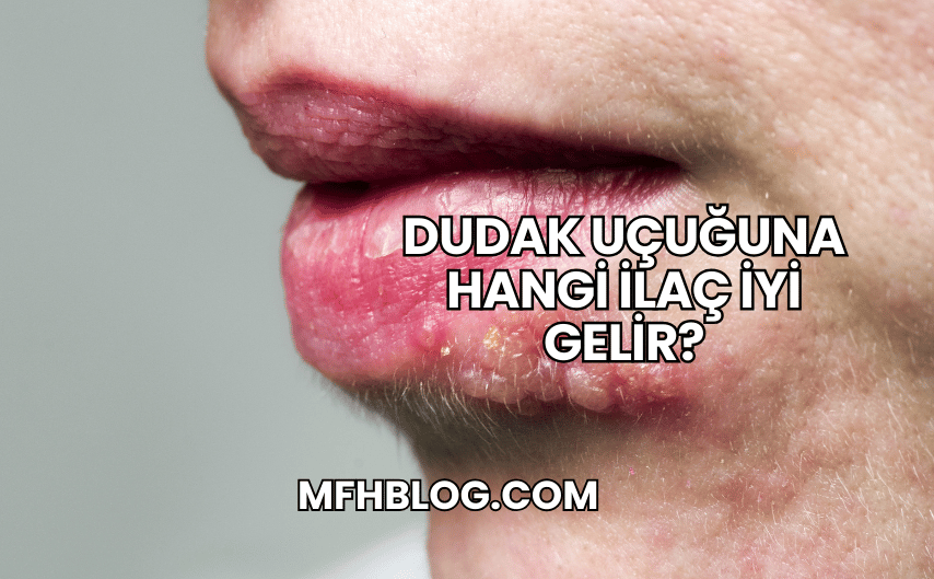 Dudak Uçuğuna Hangi İlaç İyi Gelir?