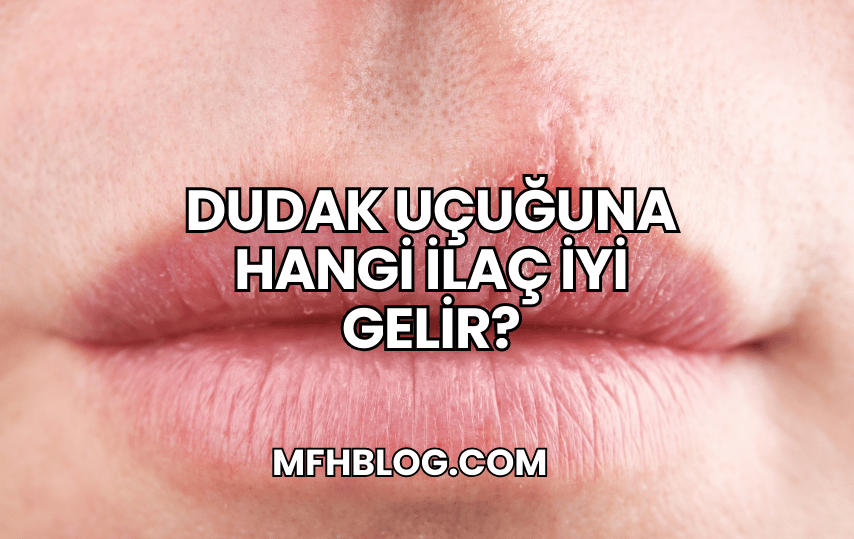 Dudak Uçuğuna Hangi İlaç İyi Gelir?