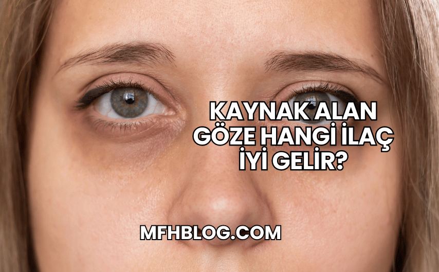 Kaynak Alan Göze Hangi İlaç İyi Gelir?