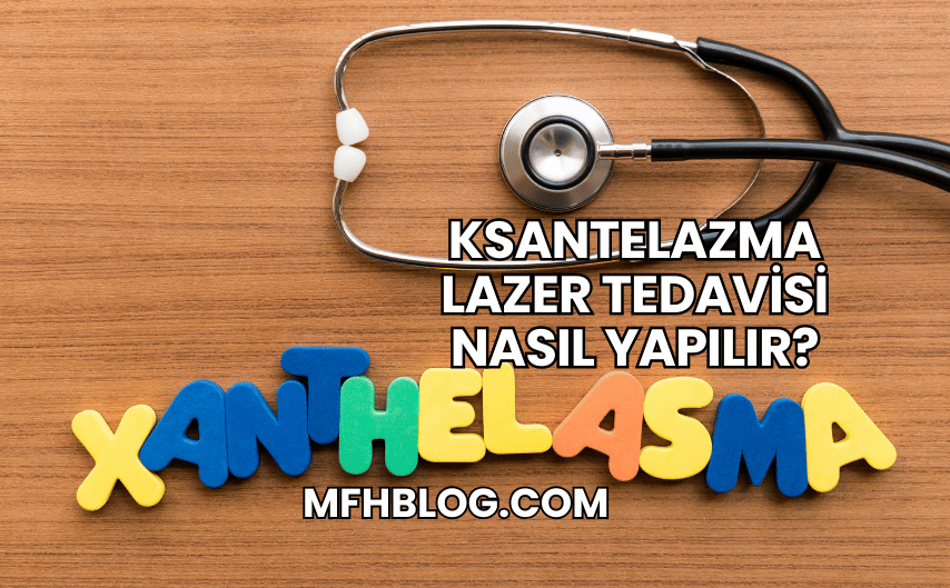 Ksantelazma Lazer Tedavisi Nasıl Yapılır?