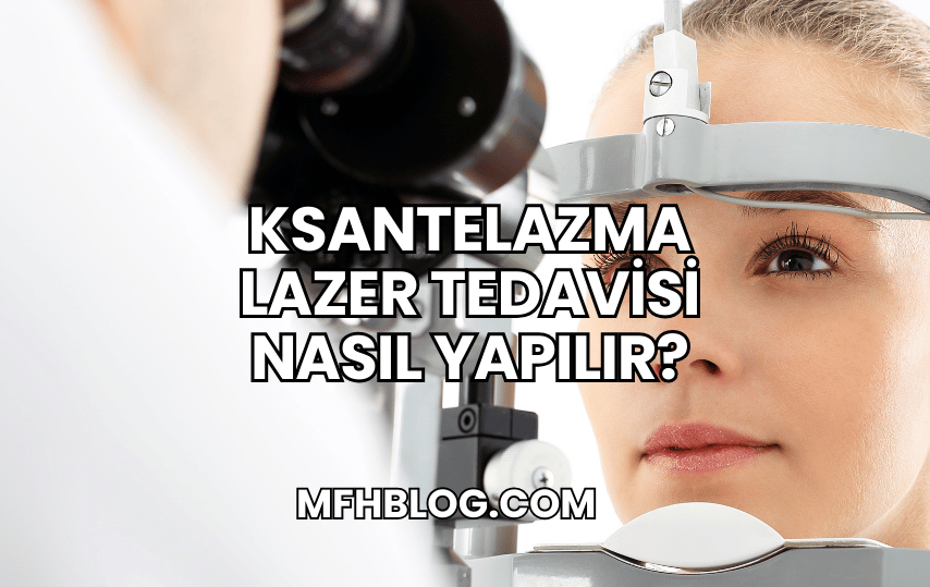 Ksantelazma Lazer Tedavisi Nasıl Yapılır?