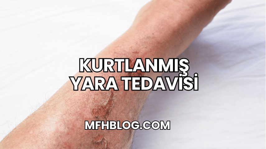 Kurtlanmış Yara Tedavisi