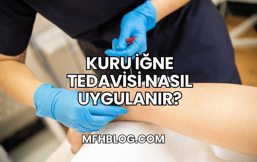 Kuru İğne Tedavisi Nasıl Uygulanır?