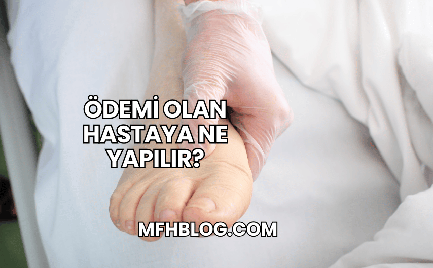 Ödemi Olan Hastaya Ne Yapılır?