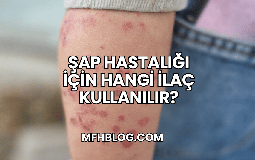 Şap Hastalığı İçin Hangi İlaç Kullanılır?