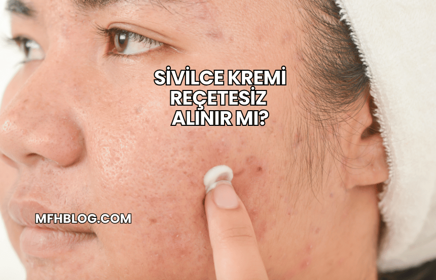 Sivilce Kremi Reçetesiz Alınır mı?