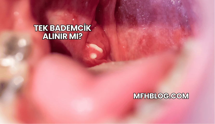 Tek Bademcik Alınır mı?