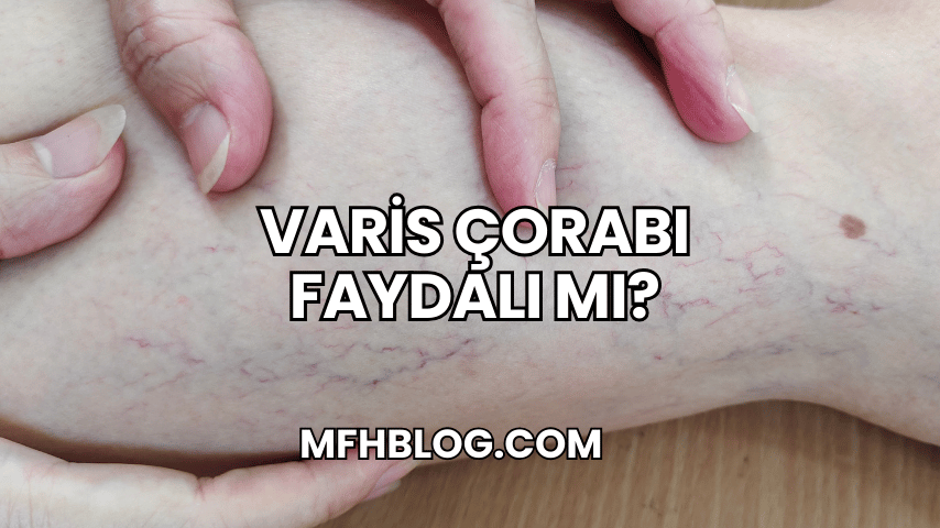 Varis Çorabı Faydalı mı?