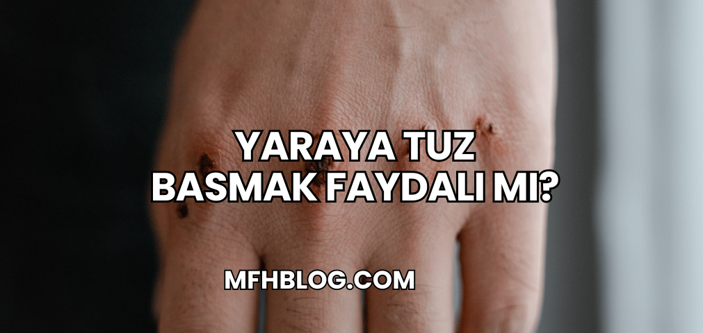 Yaraya Tuz Basmak Faydalı mı?