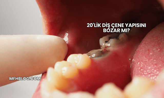 20'lik Diş Çene Yapısını Bozar mı?