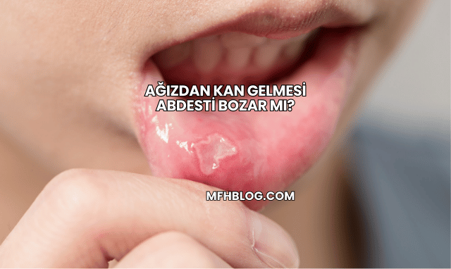 Ağızdan Kan Gelmesi Abdesti Bozar mı?