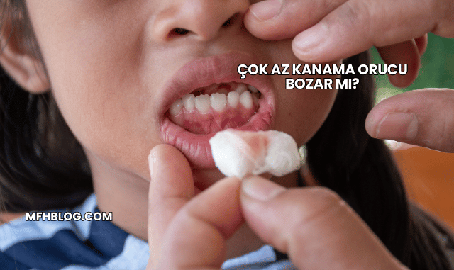 Çok Az Kanama Orucu Bozar mı?