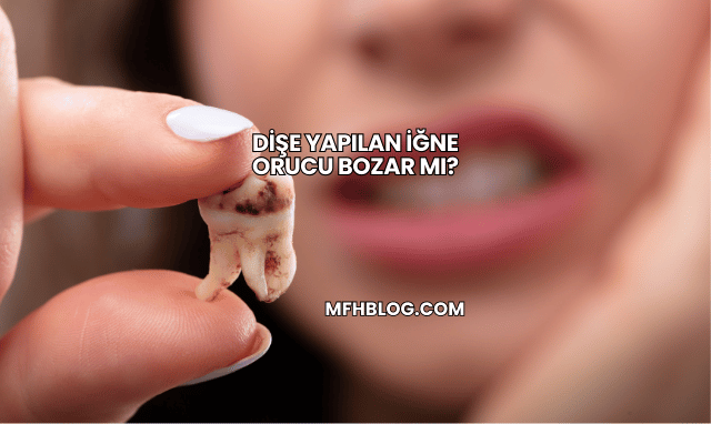 Dişe Yapılan İğne Orucu Bozar mı?