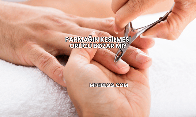 Parmağın Kesilmesi Orucu Bozar mı?