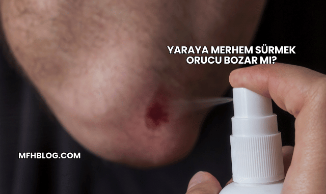 Yaraya Merhem Sürmek Orucu Bozar mı?